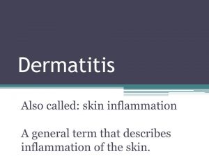 Dermatitis