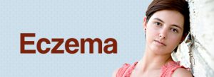Could this rash be eczema? - Colorado Allergy & Asthma Centers, P.C.