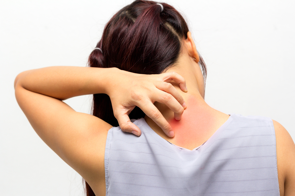 Skin Reaction to Scratching - What is it? - Colorado Allergy & Asthma  Centers, P.C.